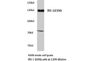 Western blot (WB) analyzes of IRS-1 antibody in extracts from A549 cells. (IRS1 anticorps)