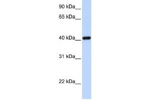 Western Blot showing IRX6 antibody used at a concentration of 1-2 ug/ml to detect its target protein. (IRX6 anticorps  (N-Term))