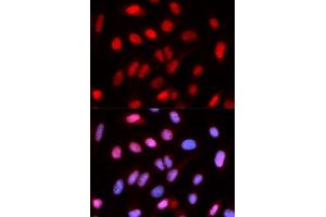 Immunofluorescence (IF) image for anti-Replication Factor C (Activator 1) 4, 37kDa (RFC4) antibody (ABIN1876673) (RFC4 anticorps)