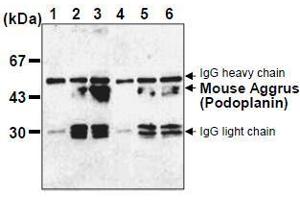 Western Blotting (WB) image for anti-Podoplanin (PDPN) antibody (ABIN1449217) (Podoplanin anticorps)