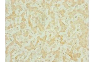 Immunohistochemistry of paraffin-embedded human liver tissue using ABIN7159686 at dilution of 1:100 (CHCHD3 anticorps  (AA 1-227))