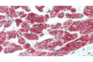 Immunohistochemistry of paraffin-embedded Heart tissue using ROR1 Polyclonal Antibody at dilution of 1:90 . (ROR1 anticorps)