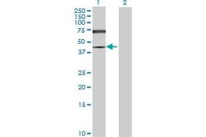 Lane 1: SMAD6 transfected lysate ( 54. (SMAD6 293T Cell Transient Overexpression Lysate(Denatured))