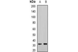 Western blot analysis of RCAS1 expression in mouse kidney (A), mouse liver (B) whole cell lysates. (RCAS1 anticorps)