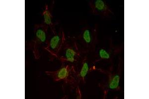 Immunofluorescence analysis of Hela cells using ESR1 mouse mAb (green). (Estrogen Receptor alpha anticorps)