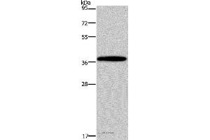 Western blot analysis of Mouse brain tissue, using DLX4 Polyclonal Antibody at dilution of 1:900 (DLX4 anticorps)