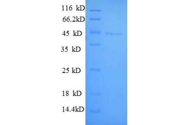 GNAI3 Protein (AA 1-354, full length) (His tag)