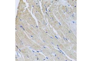 Immunohistochemistry of paraffin-embedded mouse heart using SRI antibody  at dilution of 1:100 (40x lens). (SRI anticorps  (AA 1-198))