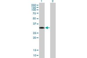 Western Blot analysis of ZBTB32 expression in transfected 293T cell line by ZBTB32 MaxPab polyclonal antibody. (ZBTB32 anticorps  (AA 1-302))