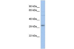 WB Suggested Anti-DLX5 Antibody Titration:  0. (DLX5 anticorps  (N-Term))
