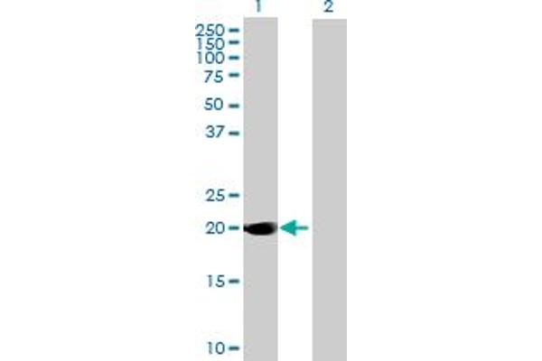 DUSP14 anticorps  (AA 1-198)