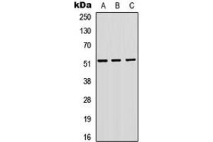 Western blot analysis of VIPR1 expression in A549 (A), H9C2 (B), Raw264. (VIPR1 anticorps  (Center))