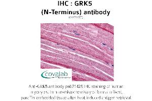 Image no. 1 for anti-G Protein-Coupled Receptor Kinase 5 (GRK5) (N-Term) antibody (ABIN1735256) (GRK5 anticorps  (N-Term))