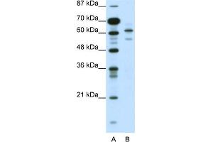 WB Suggested Anti-ZSCAN2 Antibody Titration:  0. (ZSCAN2 anticorps  (N-Term))