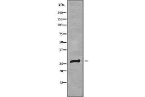 Western blot analysis of CLDN18 using Jurkat whole cell lysates (Claudin 18 anticorps)