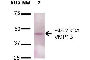 Western blot analysis of Rat Pancreas cell lysates showing detection of 46. (VMP1 anticorps  (AA 391-402) (Atto 488))
