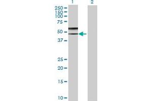 Lane 1: GCNT2 transfected lysate ( 44. (GCNT2 293T Cell Transient Overexpression Lysate(Denatured))