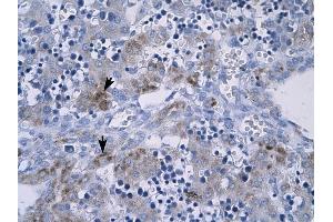 RGS9 antibody was used for immunohistochemistry at a concentration of 4-8 ug/ml to stain Hepatocytes (arrows) in Human Liver. (RGS anticorps  (N-Term))