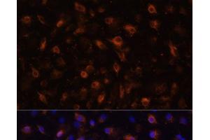 Immunofluorescence analysis of RAW264. (TLR4 anticorps)