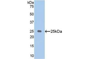 Detection of Recombinant PSA, Human using Polyclonal Antibody to Puromycin Sensitive Aminopeptidase (PSA) (NPEPPS anticorps  (AA 584-793))