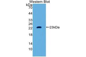 Detection of Recombinant MMP3, Human using Polyclonal Antibody to Matrix Metalloproteinase 3 (MMP3) (MMP3 anticorps  (AA 289-452))