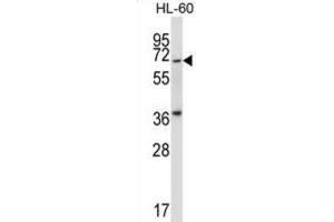 Western Blotting (WB) image for anti-Protein Kinase, Membrane Associated tyrosine/threonine 1 (PKMYT1) antibody (ABIN2997720) (PKMYT1 anticorps)