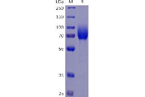 Human R Protein, His Tag on SDS-PAGE under reducing condition. (CSF1R Protein (AA 20-514) (His tag))