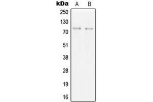 Western blot analysis of SYK expression in BJAB (A), Ramos (B) whole cell lysates. (SYK anticorps  (Center))