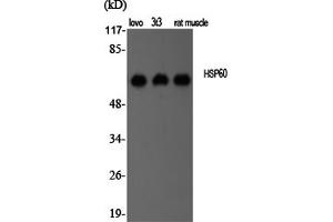Western Blotting (WB) image for anti-Heat Shock 60kDa Protein 1 (Chaperonin) (HSPD1) antibody (ABIN5956900) (HSPD1 anticorps)