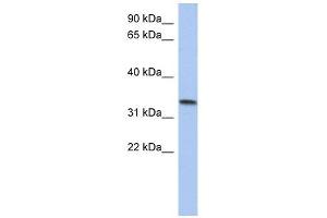 C10ORF96 antibody used at 1 ug/ml to detect target protein. (C10ORF96 anticorps  (Middle Region))