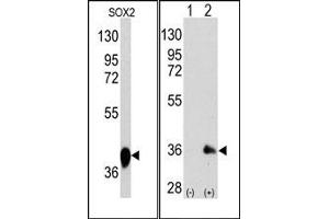 Western Blotting (WB) image for anti-SRY (Sex Determining Region Y)-Box 2 (SOX2) antibody (ABIN356387) (SOX2 anticorps)