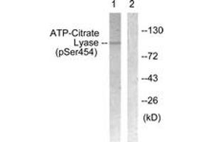 Western blot analysis of extracts from COS7 cells treated with Calyculin 50nM 30', using ATP-Citrate Lyase (Phospho-Ser454) Antibody. (ACLY anticorps  (pSer455))