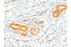 Immunohistochemistry (IHC) image for anti-Nuclear Factor-kB p65 (NFkBP65) (pSer536) antibody (ABIN6255402)