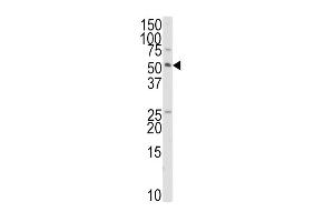 Western blot analysis of anti-TRAIP Antibody in HepG2 cell line lysates (35ug/lane). (TRAIP anticorps  (C-Term))