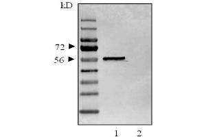 Image no. 1 for anti-Tumor Protein P53 (TP53) antibody (ABIN2704417)