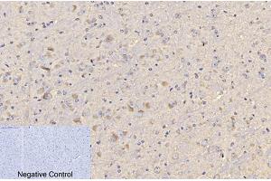 Immunohistochemical analysis of paraffin-embedded mouse brain tissue. (CD4 anticorps)