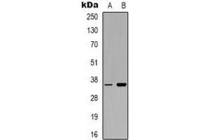 Western blot analysis of CD321 expression in Hela (A), PC12 (B) whole cell lysates. (F11R anticorps)