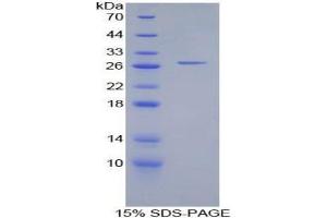 SDS-PAGE analysis of Cow Cathepsin S Protein. (Cathepsin S Protein (CTSS))