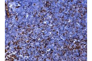 Immunohistochemistry (IHC) image for anti-Vimentin (VIM) antibody (ABIN2854814)