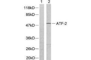 Western blot analysis of extracts from LOVO cells using ATF-2 (Ab-73 or 55) antibody (E021032). (ATF2 anticorps)