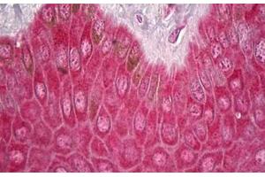 Anti-FOS / c-FOS antibody IHC staining of human skin. (c-FOS anticorps)