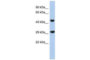 C22ORF25 antibody used at 1 ug/ml to detect target protein. (C22orf25 anticorps  (N-Term))