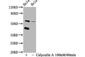 Western Blot Positive WB detected in Hela whole cell lysate(treated with Calyculin A or not) All lanes Phospho-EIF2AK2 antibody at 1. (Recombinant EIF2AK2 anticorps  (pThr446))