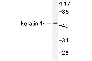 Image no. 1 for anti-Keratin 14 (KRT14) antibody (ABIN265493) (KRT14 anticorps)