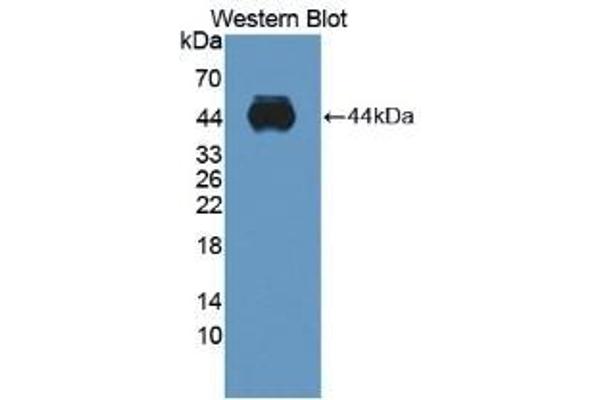 ADAMTS10 anticorps  (AA 239-602)
