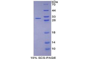 SDS-PAGE (SDS) image for Fibulin 1 (FBLN1) ELISA Kit (ABIN6720586)