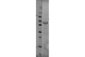 SDS-PAGE of OspC Control Protein. (OspC Protéine)