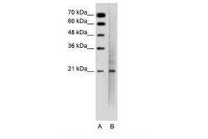 Image no. 2 for anti-Mucin 1 (MUC1) (C-Term) antibody (ABIN6736343) (MUC1 anticorps  (C-Term))