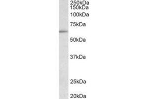 AP32030PU-N HIC2 / ZBTB30 Antibody staining of HepG2 lysate at 0. (HIC2 anticorps  (Internal Region))