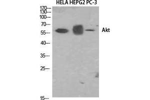 Western Blot (WB) analysis of HELA, HepG2, PC-3 using Akt1 Polyclonal Antibody. (AKT1 anticorps  (N-Term))